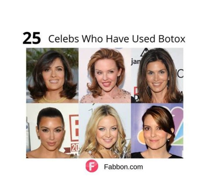 Botox Commercial Actress Names List 2023