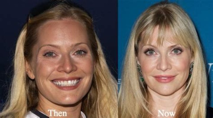 Emily Procter Plastic Surgery Before and After