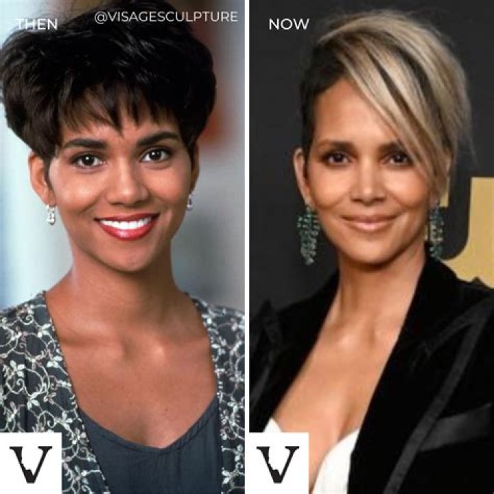 Halle Berry Breast Implants Plastic Surgery Before and After