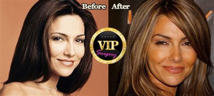 Vanessa Marcil Plastic Surgery Before and After